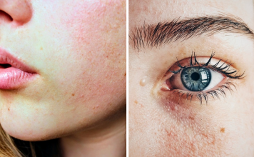 12 Signs You Are Eating Too Much Sugar